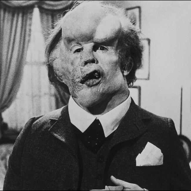 The Elephant Man (1980) - David Lynch